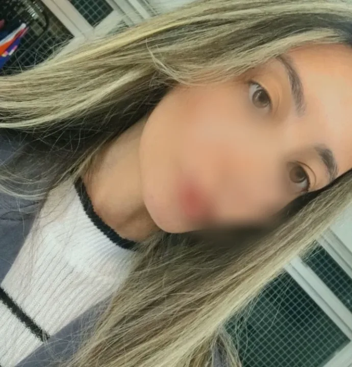 Carmen, 20 años